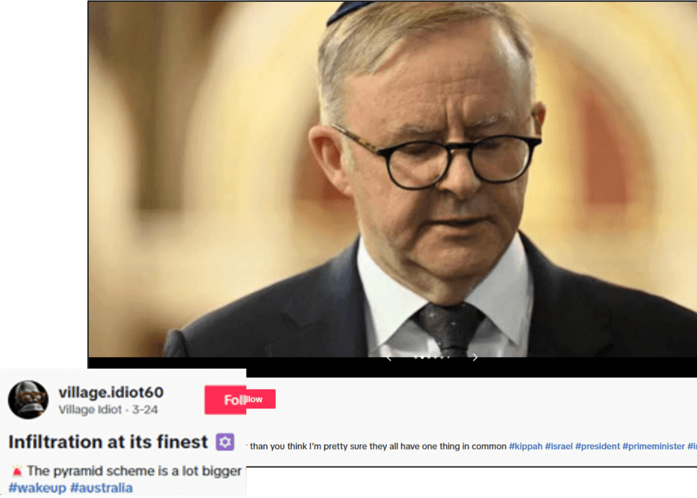 Image of Anthony Albanese wearing a skullcap